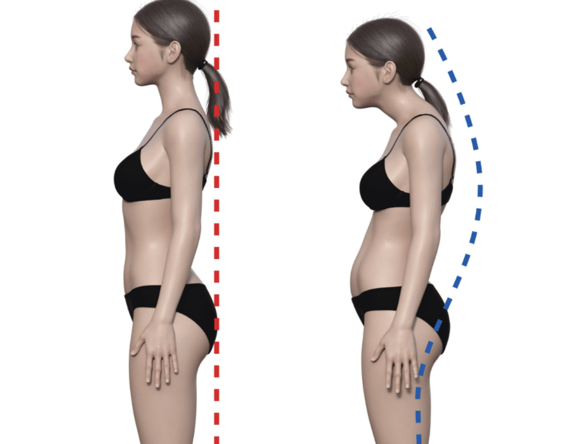 船堀で猫背でお悩みの方へ］ - 江戸川区船堀 はればれ鍼灸整骨院