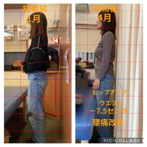 ウエストが-7.5センチ減少した女性