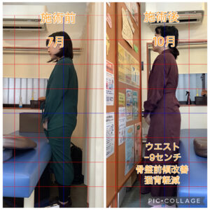 ウエストが-9センチ減少した女性