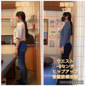 ウエストが-9センチ減少した女性